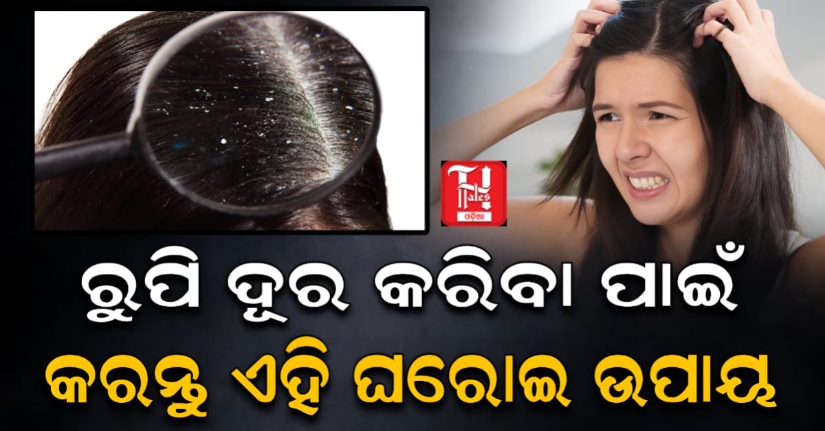 Health Tips: ରୁପି ଦୂର କରିବା ପାଇଁ ଘରୋଇ ଉପଚାର
